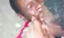Man gets part of his face bitten off in a fight!