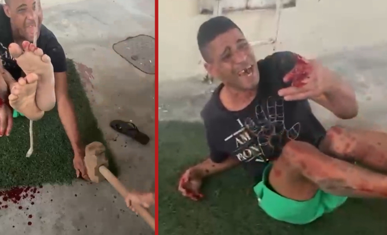 Thief captured by locals; fingers shattered with sledgehammer in act of vigilante justice - Brazil