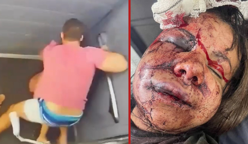 Man arrested for attempted femicide after brutally attacking girlfriend with over 60 punches in apartment elevator; victim hospitalized with facial fractures - Brazil