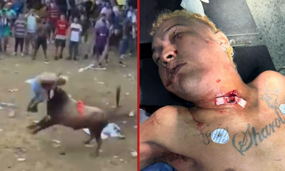 Man with bandaged arm killed after being gored in neck during bull run - Colombia