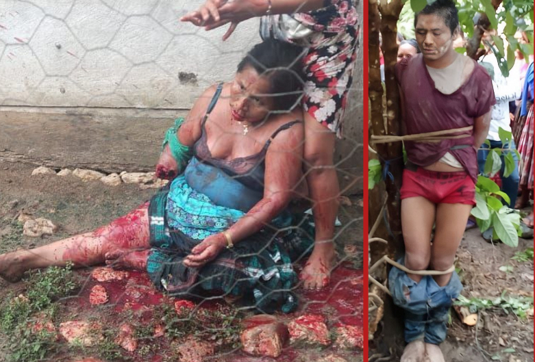 Son attacks mother with machete, amputating her forearm in Chisec - Guatemala