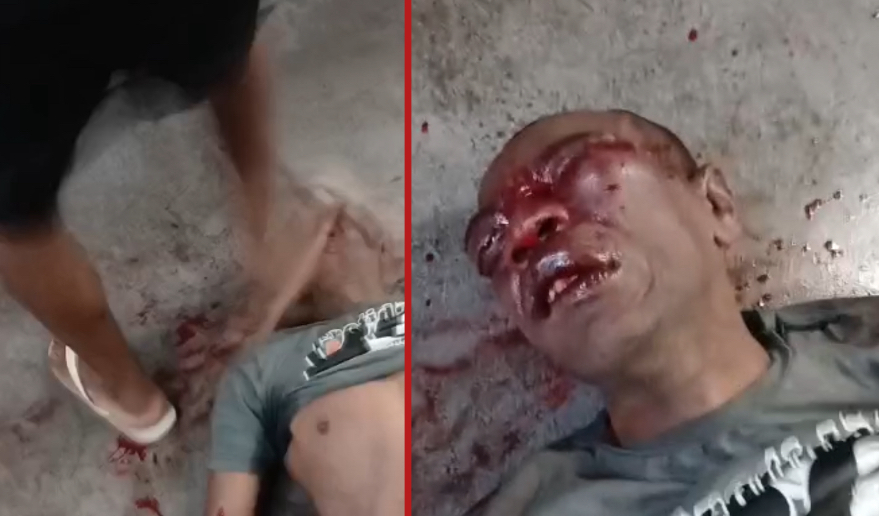 Man accused of robbing women on train beaten and left with disfigured face in Nova Iguaçu - Brazil