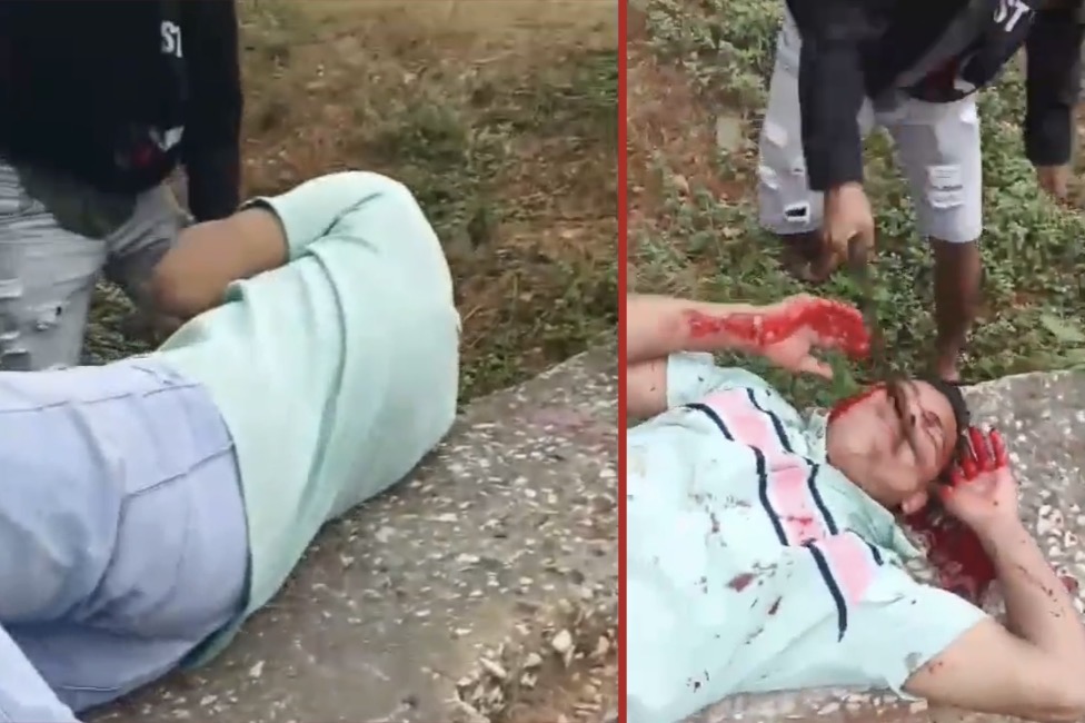 Young man kidnapped and hacked with machete, attackers flee with his motorcycle - Ecuador