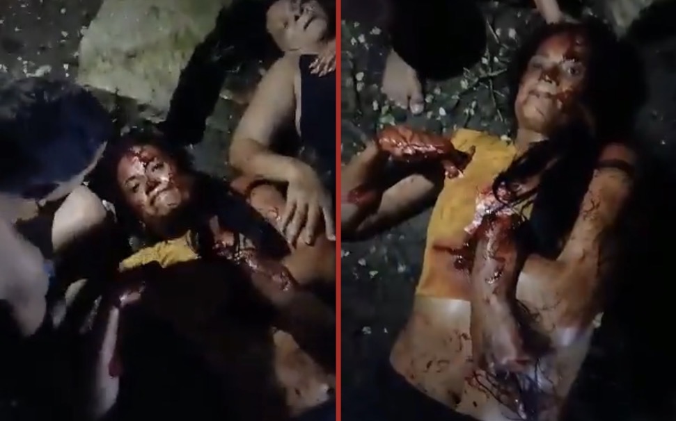 Woman killed and her mother injured in brutal machete attack by ex-boyfriend in Guáimaro - Cuba