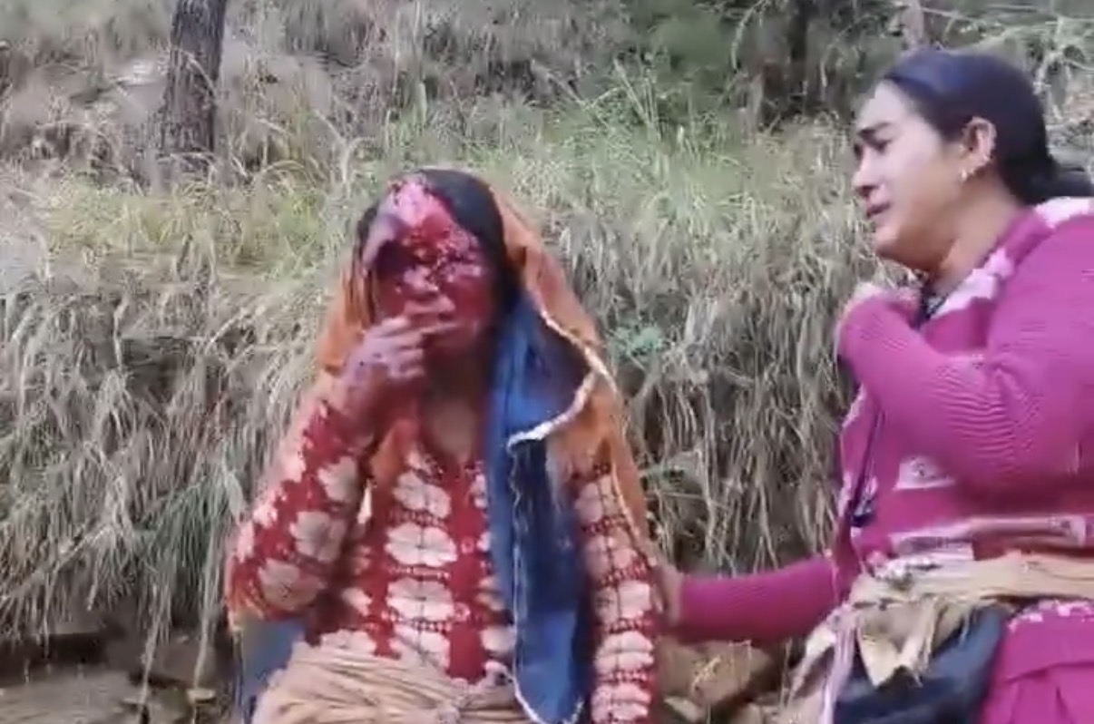 Woman seriously injured in bear attack while collecting grass - India
