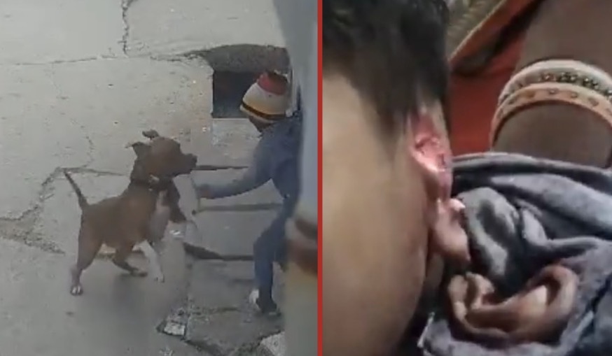 Delhi child mauled in severe pit bull attack as owner taken into custody - India