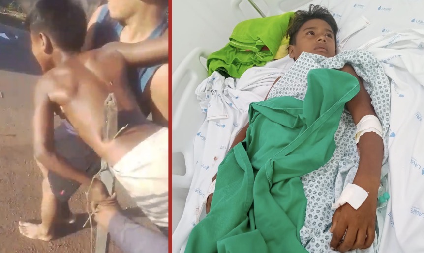 Boy is impaled by a wooden post while retrieving a kite - Brazil