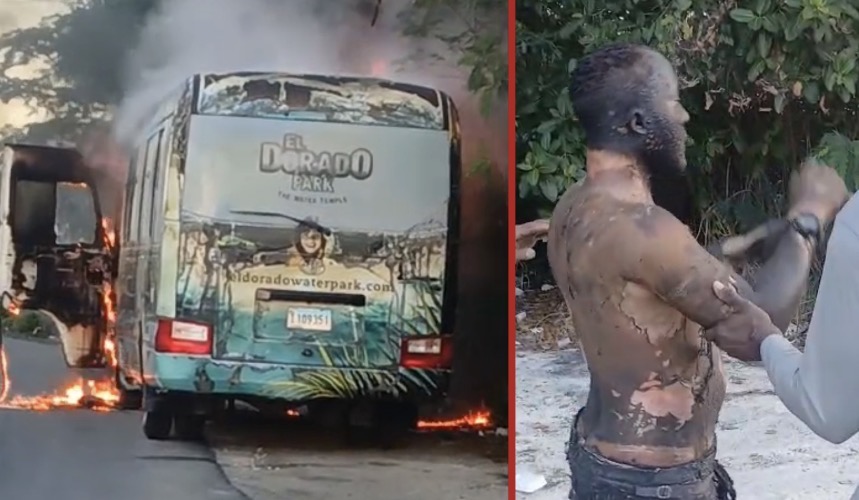 Bus engulfed in flames leaves driver with severe burns as authorities investigate cause of fire - Dominican Republic