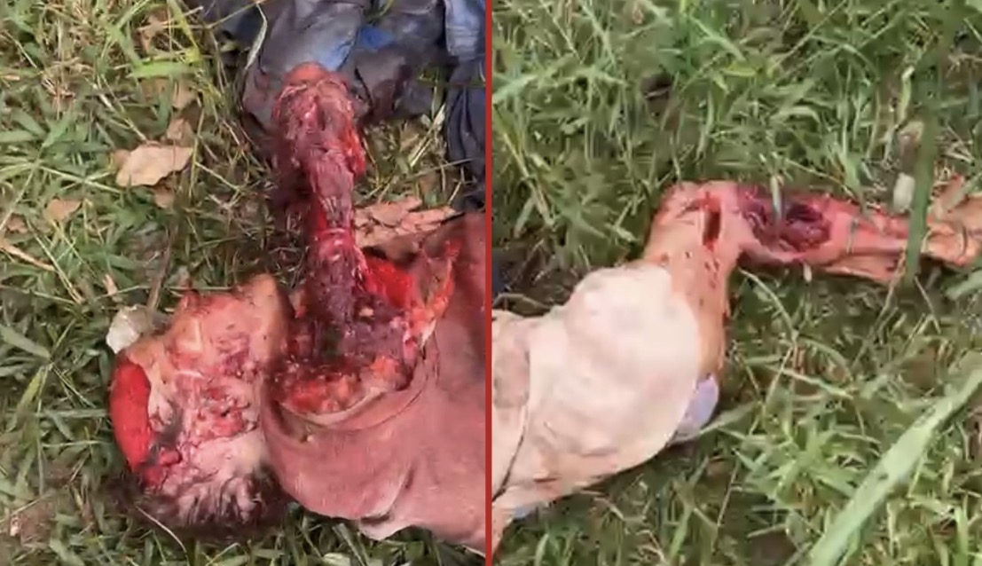 69-year-old woman severely injured in dog attack; owner arrested - Brazil