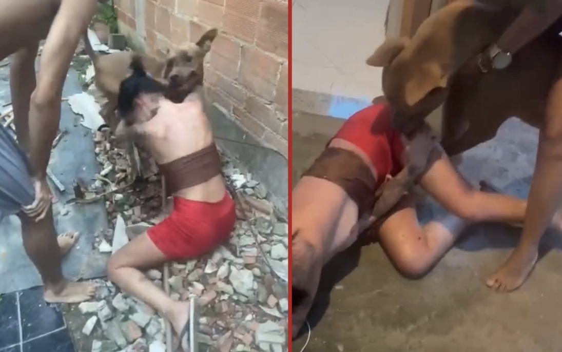 Young woman brutally attacked by family-owned pit bull amid allegations relatives incited the assault - Brazil